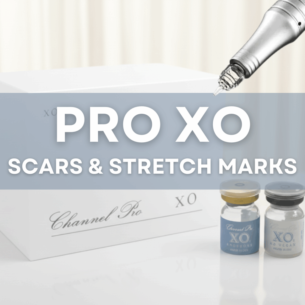 Channel Pro XO Scars, deep wrinkles and stretch marks treatment protocol - Microchanneling protocol